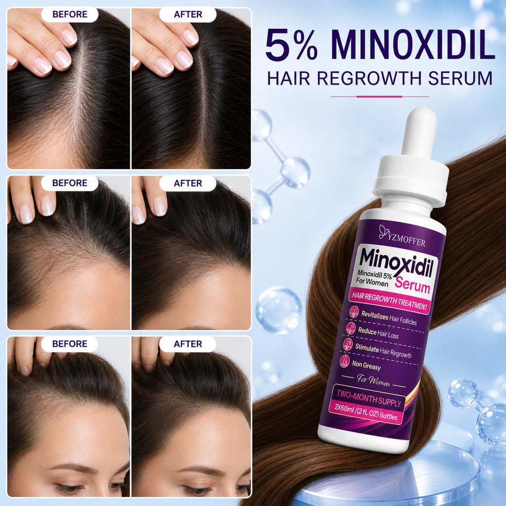 SekretSistar Hair Growth Support Minoxidil Treatment
