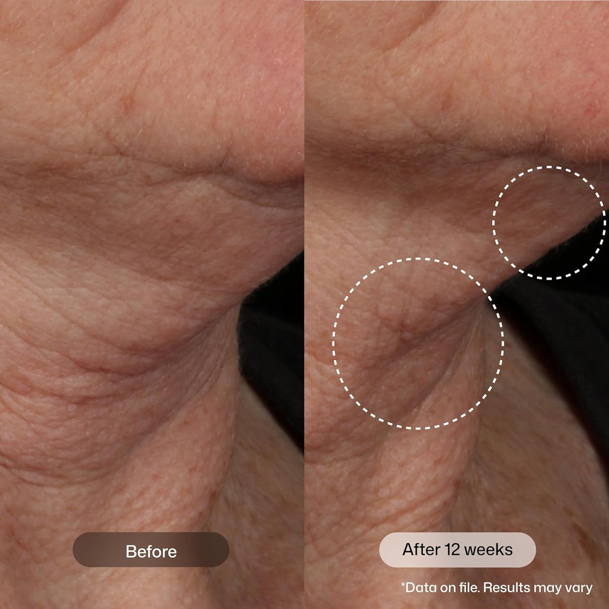 SekretSistar Advanced Neck & Décolletage Firming Cream